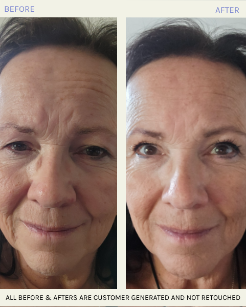 The Solution® Skin Transformer