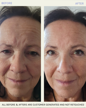 The Solution® Skin Transformer Ritual