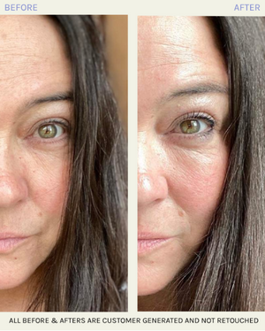 The Solution® Skin Transformer Ritual