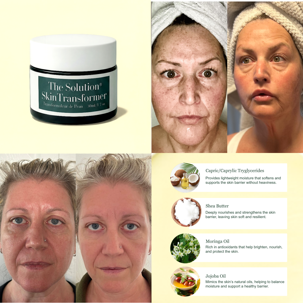 The Solution® Skin Transformer
